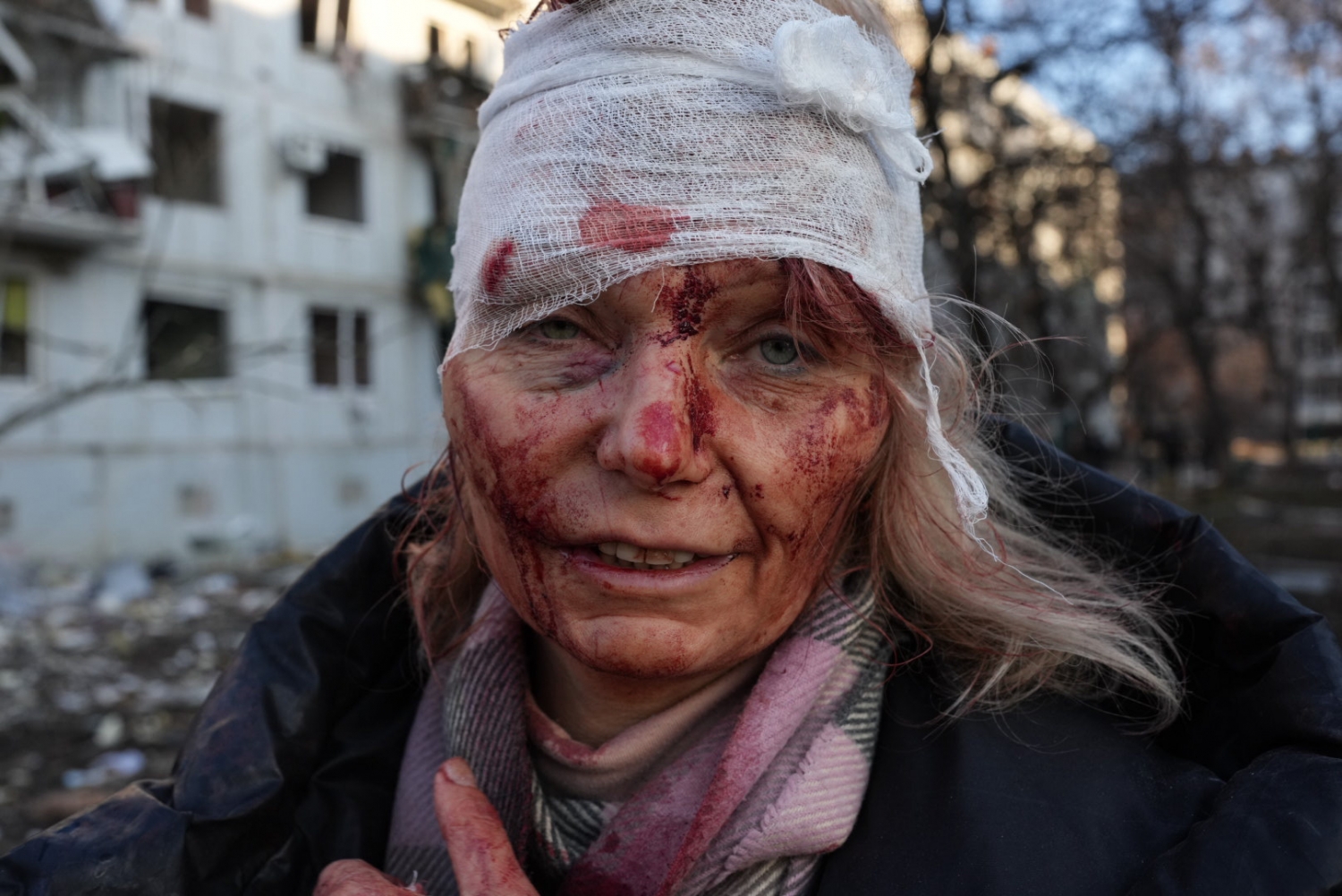 KHARKIV, UKRAINE - FEBRUARY 24: (EDITORS NOTE: Image depicts graphic content) A wounded woman is seen as airstrike damages an apartment complex outside of Kharkiv, Ukraine on February 24, 2022. (Photo by Wolfgang Schwan/Anadolu Agency via Getty Images)